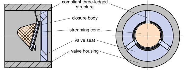 Figure: Novel excess flow valve with compliant three-ledged structure
